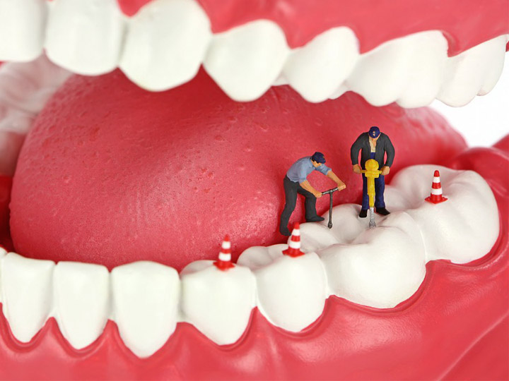 Восстановление и реставрация зубов